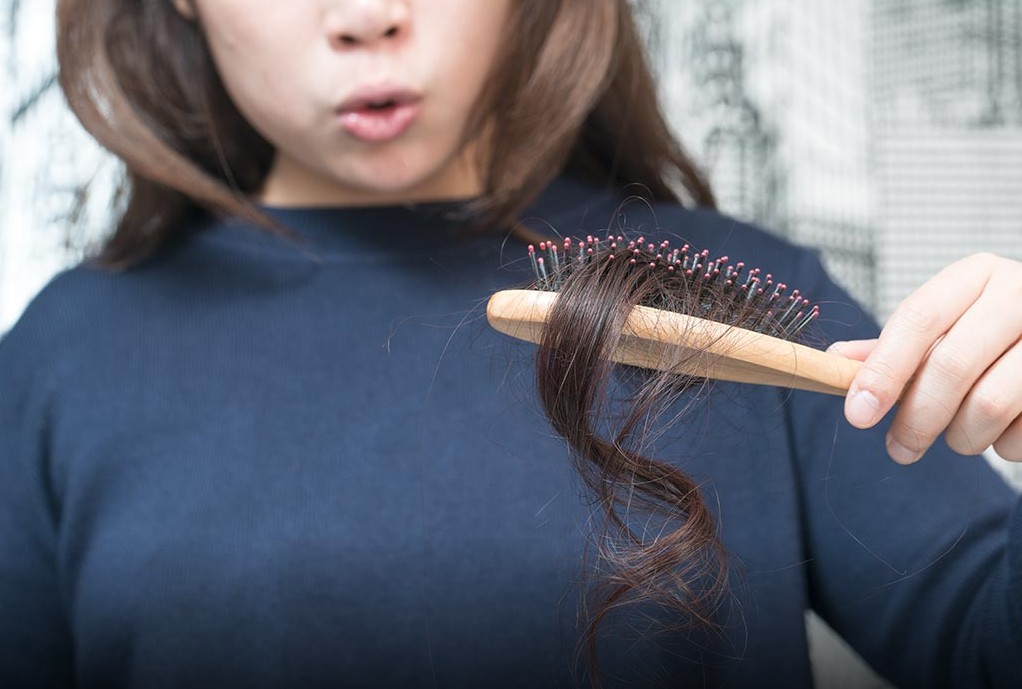 Meilleurs remèdes contre la perte de cheveux en 2020