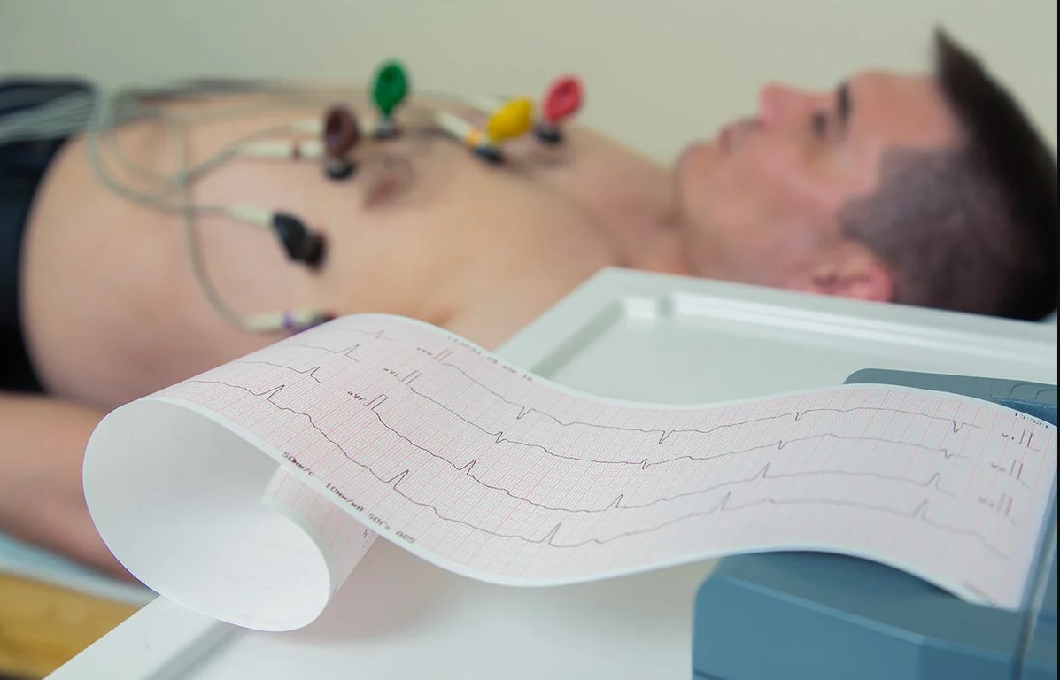 Classement des meilleurs électrocardiographes pour 2020